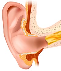 Vad &auml;r &ouml;ronvax?